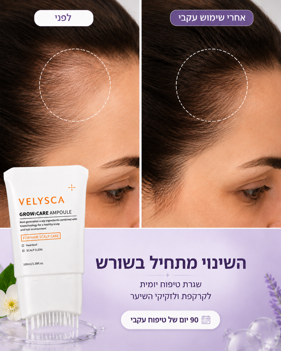 סרום Velysca™ להחייאת שורשי השיער