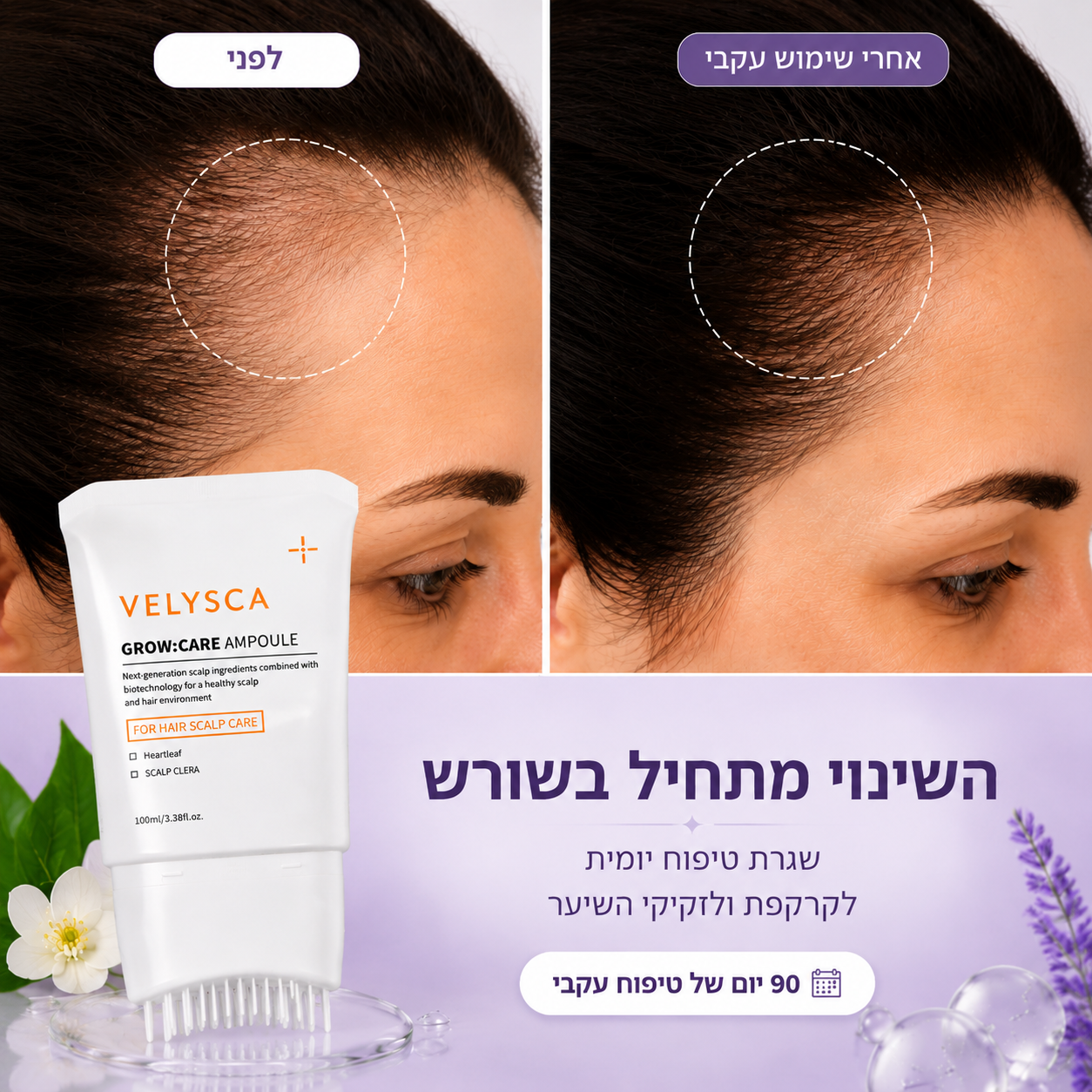 Feature product image